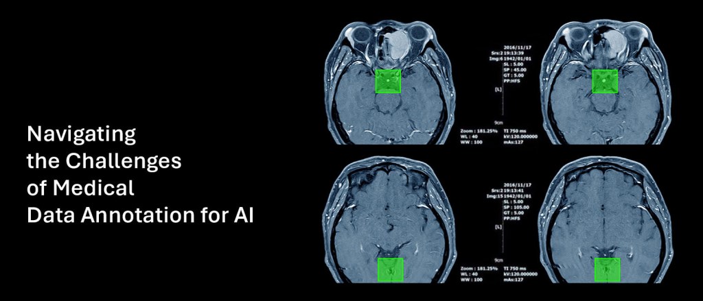 Navigating the Challenges of Medical Data Annotation for&nbsp;AI